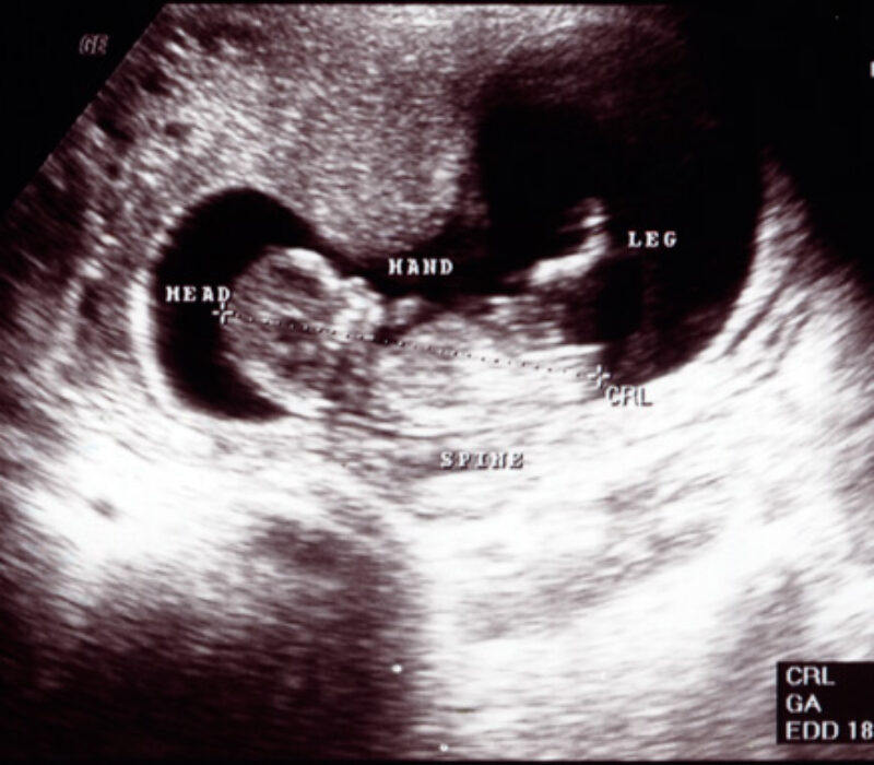 Konferanse 2.–3. desember: Fosterdiagnostikk – individ og samfunn