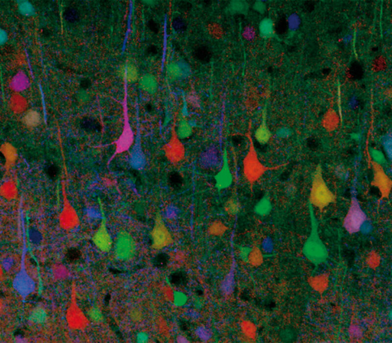 Fargerike bilder gir innsikt i cellers funksjon