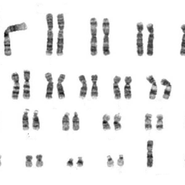Leder i GENialt: Idrettens gentesting bør skje i Norge