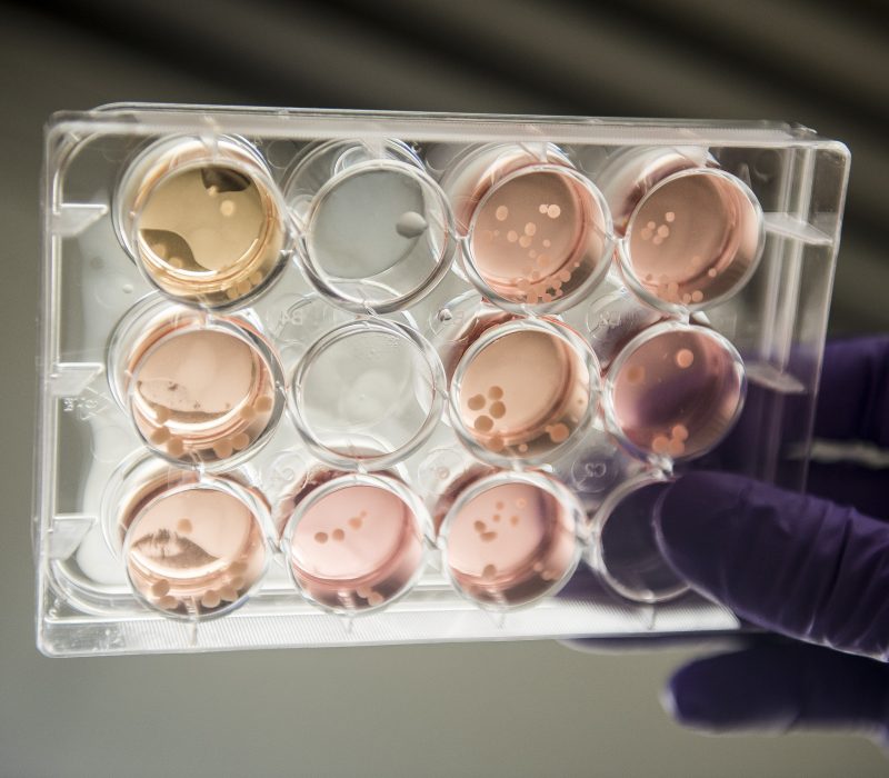 I GENialt: Minihjerner med hjernebølger skaper debatt