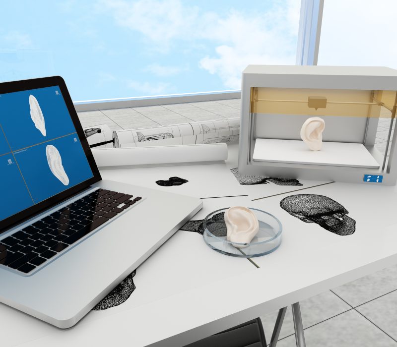 I GENialt: Nytt øyre med 3D-skrivar