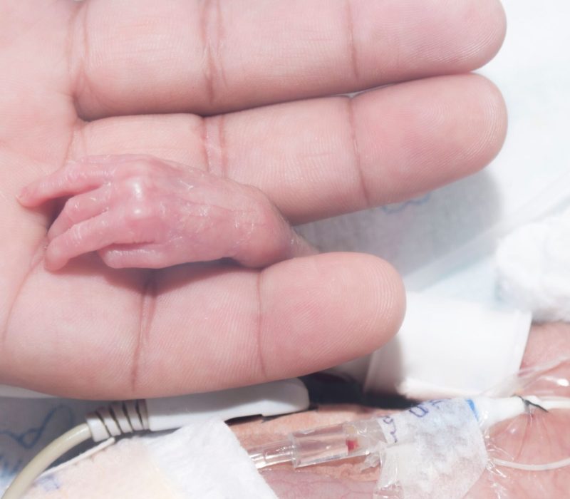 Kunstig livmor som kuvøse