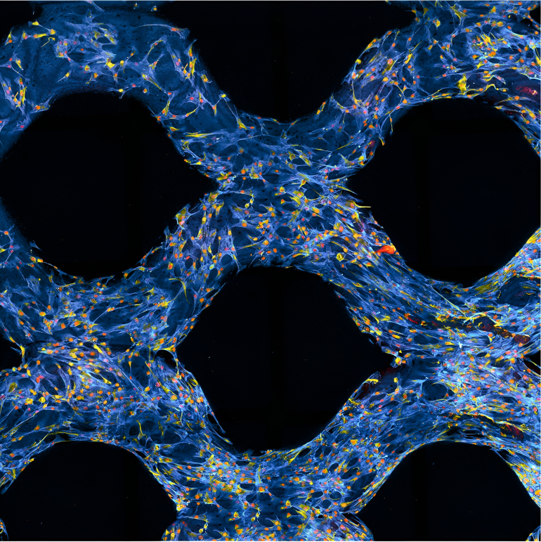 Fotografiet viser beinmargsstamceller 3D-printet sammen med et gelatinbasert materiale. 