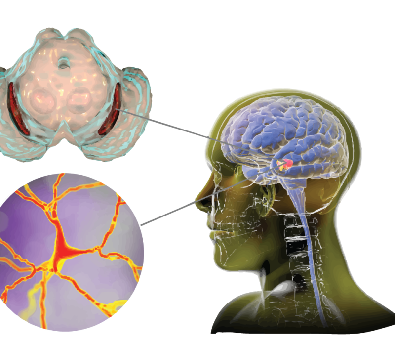 SmåGENialt: Hvorfor får noen Parkinsons sykdom?