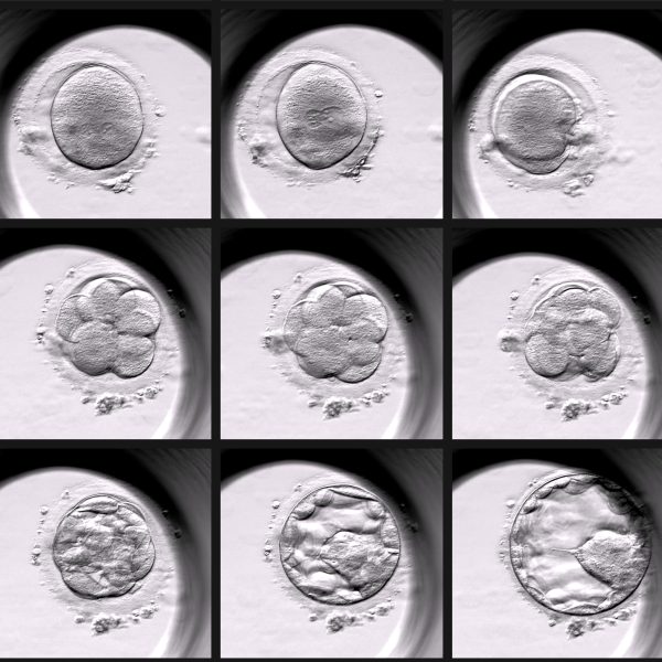 Embryo frå minutt til minutt